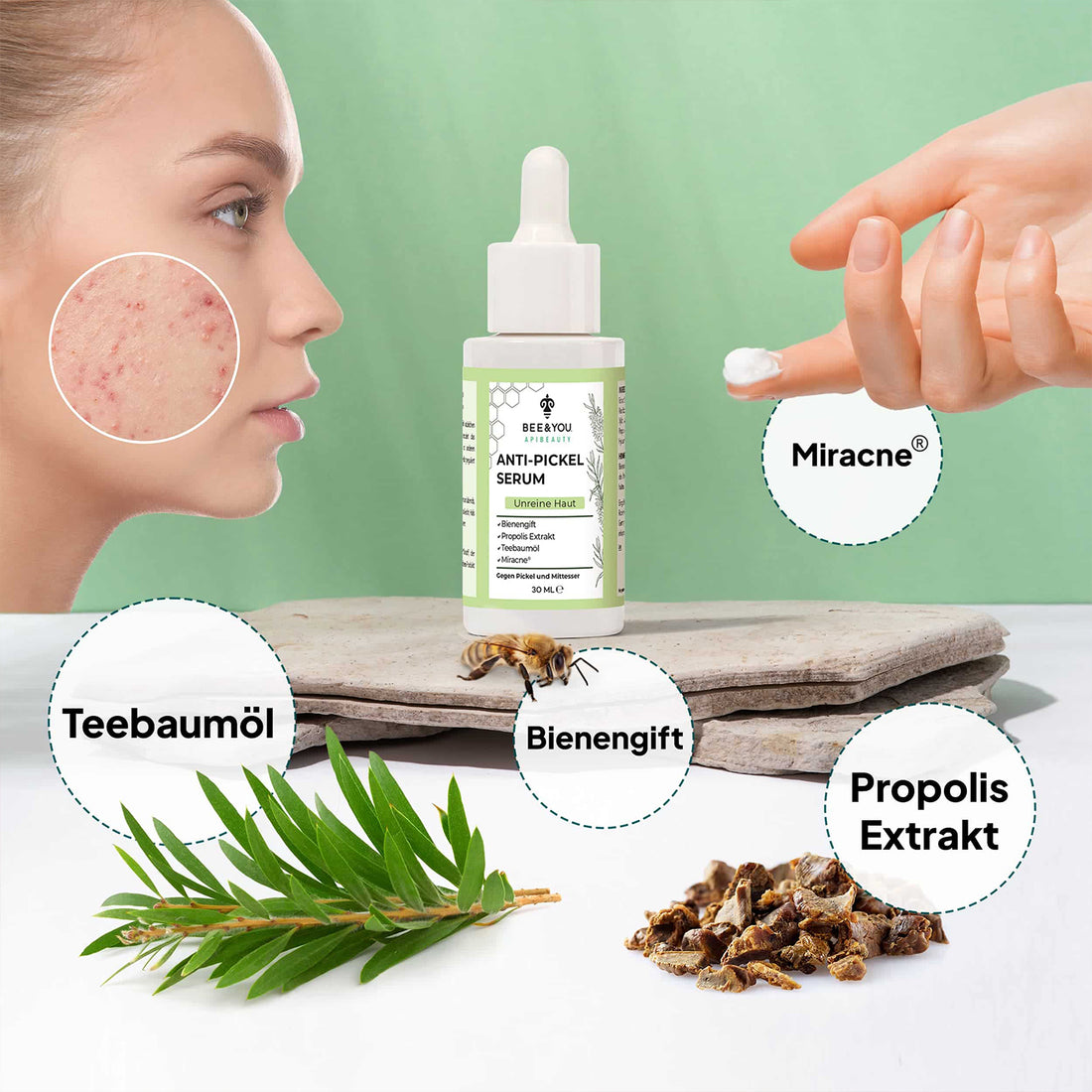 Anti Acne Serum